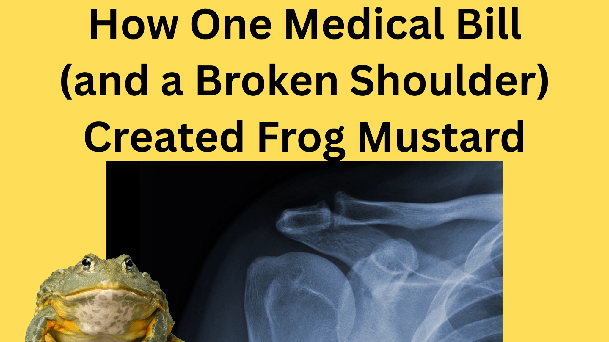 🐸 How a Broken Shoulder (and a Medical Bill) Launched the Funniest Bumper Sticker Shop on the Internet (In Our Opinion) - Frog Mustard Stickers