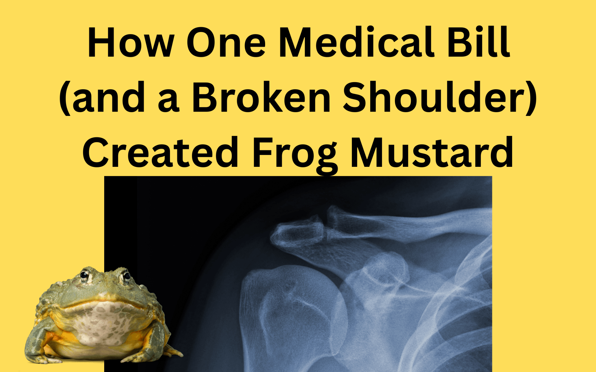 🐸 How a Broken Shoulder (and a Medical Bill) Launched the Funniest Bumper Sticker Shop on the Internet (In Our Opinion) - Frog Mustard Stickers